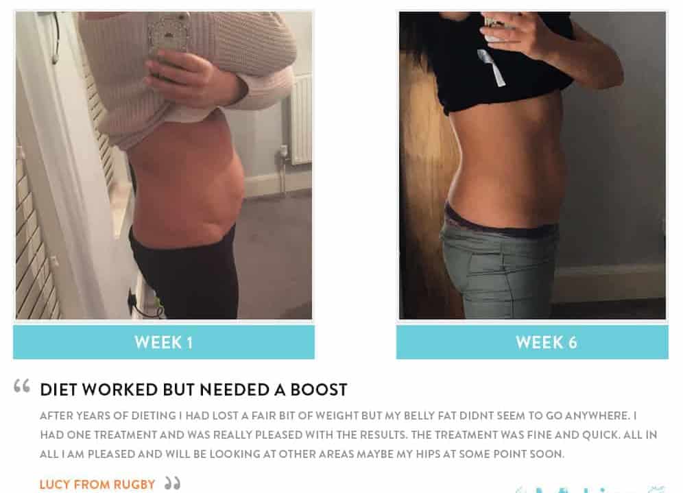 Before and After Dieting Richmond