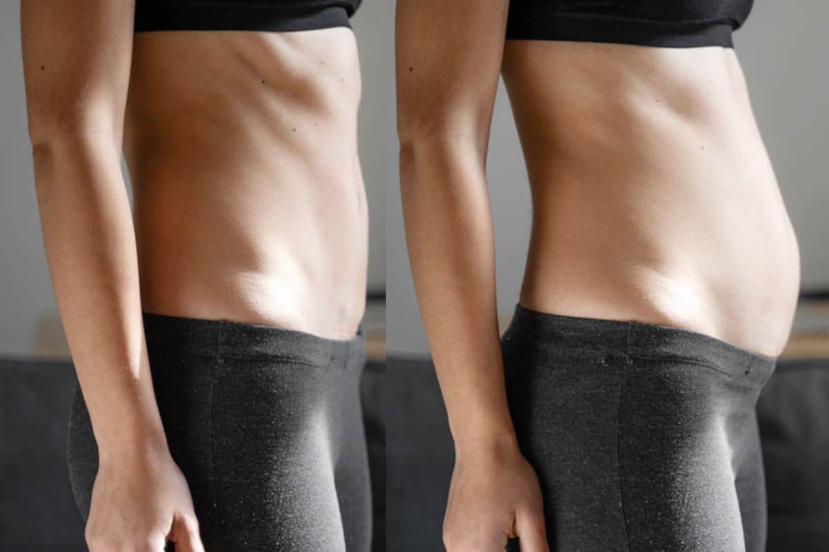 How long does diastasis recti take to improve Richmond?