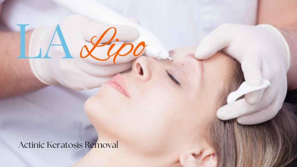 actinic keratosis removal Richmond
