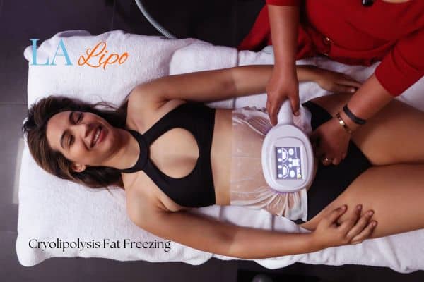 woman getting cryolipolysis Richmond