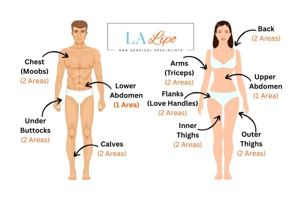 LA LIPO Cryolipolysis Areas Richmond