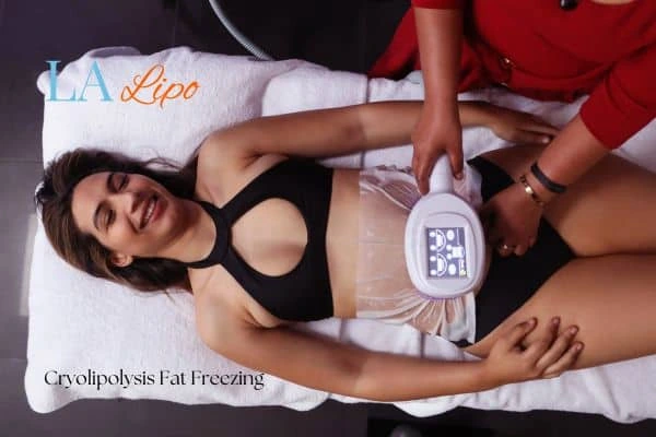 woman getting cryolipolysis Richmond